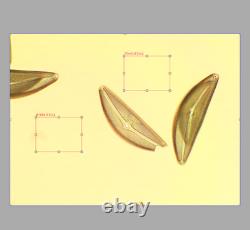 Exce Nikon Plan Apo 10x / 0.4 160mm 0.17 Microscope Objective Lens RMS 34080