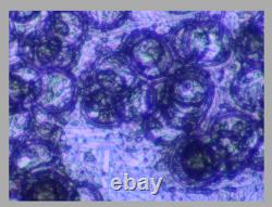 Mint M Plan 40 / 0.4 ULWD 210/0 WD 15 Microscope Objective Lens RMS 34849