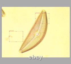 Mint Nikon Plan 40x/0.70 160/0.17 Microscope Objective Lens RMS 34167